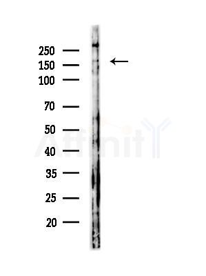 Phospho-ROCK1 (Ser282) Antibody - Western blot analysis of lysates from COLO205 cells, using Phospho-ROCK1 (Ser282) Antibody at 1/1000 dilution.