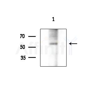 Phospho-Occludin (Thr382) Antibody - Western blot analysis of lysates from 293 cells(starvation treatment), using Phospho-Occludin (Thr382) Antibody at 1/1000 dilution.