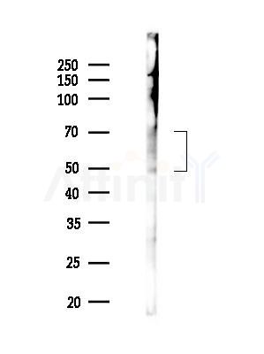 Phospho-Occludin (Thr382) Antibody - Western blot analysis of lysates from 293 cells(starvation,24h treatment), using Phospho-Occludin (Thr382) Antibody at 1/1000 dilution.