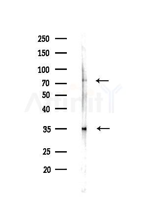 Phospho-Occludin (Ser507 ) Antibody - Western blot analysis of lysates from HepG2 cells, using Phospho-Occludin (Ser507 ) Antibody at 1/1000 dilution.