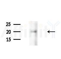 Phospho-Claudin 5 (Thr207 ) Antibody - Western blot analysis of lysates from LoVo cells(heat-shock,45min treatment), using Phospho-Claudin 5 (Thr207 ) Antibody at 1/1000 dilution.