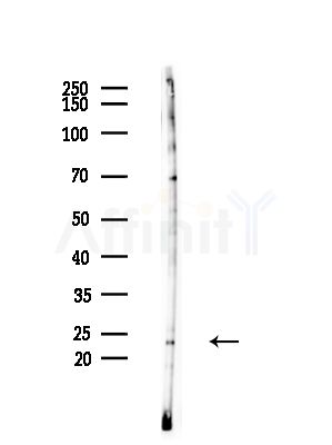 Phospho-Claudin 5 (Thr207 ) Antibody - Western blot analysis of lysates from LoVo cells(heat-shock,45min treatment), using Phospho-Claudin 5 (Thr207 ) Antibody at 1/1000 dilution.