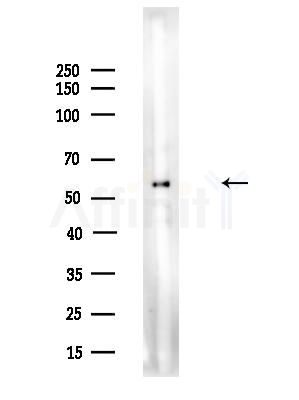 Phospho-PHGDH (Thr78) Antibody - Western blot analysis of lysates from A375 cells(LPS,4h treatment), using Phospho-PHGDH (Thr78) Antibody at 1/1000 dilution.