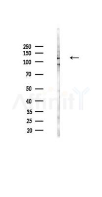 Phospho-ASPP2 (Ser698) Antibody - Western blot analysis of lysates from HUVEC cells(UV,30min treatment), using Phospho-ASPP2 (Ser698) Antibody at 1/1000 dilution.