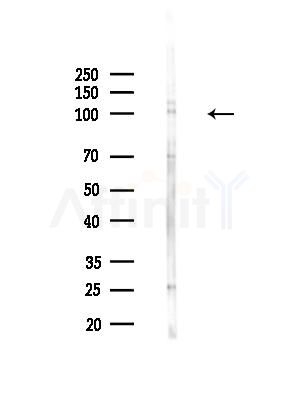 Phospho-NLRP3 (Ser295) Antibody - Western blot analysis of lysates from HepG2 cells, using Phospho-NLRP3 (Ser295) Antibody at 1/1000 dilution.