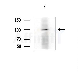Phospho-SLP76 (Tyr173) Antibody - Western blot analysis of extracts from HepG2 cells, using Phospho-SLP76 (Tyr173) Antibody at 1/1000 dilution.