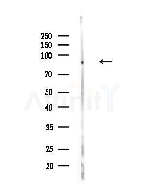 Phospho-SLP76 (Tyr173) Antibody - Western blot analysis of lysates from HepG2 cells, using Phospho-SLP76 (Tyr173) Antibody at 1/1000 dilution.