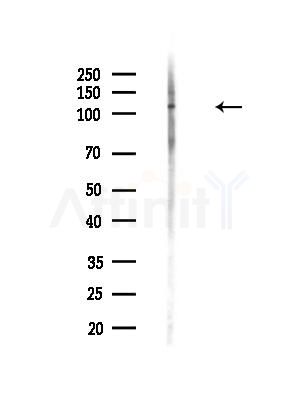 Phospho-ITCH (Tyr420) Antibody - Western blot analysis of lysates from HepG2 cells, using Phospho-ITCH (Tyr420) Antibody at 1/1000 dilution.