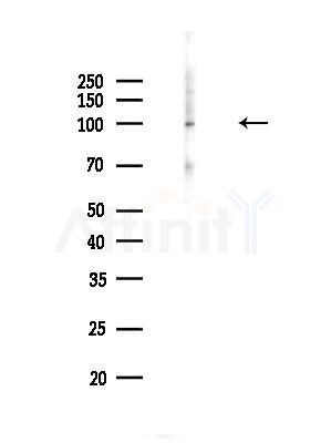 Phospho-alpha-Actinin (Tyr193) Antibody - Western blot analysis of lysates from 293 cells(starvation,24h treatment), using Phospho-alpha-Actinin (Tyr193) Antibody at 1/1000 dilution.
