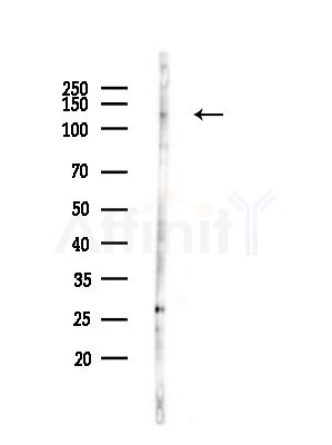 Phospho-APAF1 (Ser320) Antibody - Western blot analysis of lysates from HUVEC cells(LPS,4h treatment), using Phospho-APAF1 (Ser320) Antibody at 1/1000 dilution.