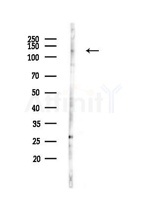 Phospho-APAF1 (Ser320) Antibody - Western blot analysis of lysates from HUVEC cells(LPS,4h treatment), using Phospho-APAF1 (Ser320) Antibody at 1/1000 dilution.