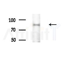 Phospho-TAB2 (Ser450) Antibody - Western blot analysis of extracts from Mouse liver, using Phospho-TAB2 (Ser450) Antibody at 1/1000 dilution.