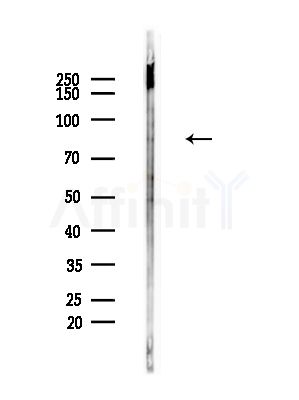 Phospho-TAB2 (Ser450) Antibody - Western blot analysis of lysates from Mouse liver, using Phospho-TAB2 (Ser450) Antibody at 1/1000 dilution.