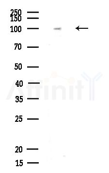 Phospho-NEDD4 (Ser670) Antibody - Western blot analysis of lysates from Rat liver, using Phospho-NEDD4 (Ser670) Antibody at 1/1000 dilution.