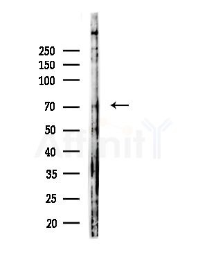 Phospho-PABP1 (Tyr364) Antibody - Western blot analysis of lysates from COLO205 cells, using Phospho-PABP1 (Tyr364) Antibody at 1/1000 dilution.