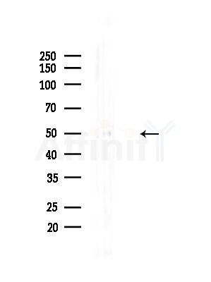 Phospho-PABP2 (Ser150) Antibody - Western blot analysis of lysates from HUVEC cells(LPS,4h treatment), using Phospho-PABP2 (Ser150) Antibody at 1/1000 dilution.