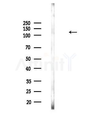 Phospho-KSR1 (Thr425) Antibody - Western blot analysis of lysates from HepG2 cells, using Phospho-KSR1 (Thr425) Antibody at 1/1000 dilution.