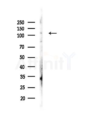 Phospho-KSR2 (Thr497) Antibody - Western blot analysis of lysates from COLO205 cells, using Phospho-KSR2 (Thr497) Antibody at 1/1000 dilution.