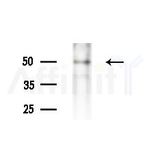 Phospho-NAKED2 (Tyr247) Antibody - Western blot analysis of extracts from HUVEC cells(LPS,4h treatment), using Phospho-NAKED2 (Tyr247) Antibody at 1/1000 dilution.