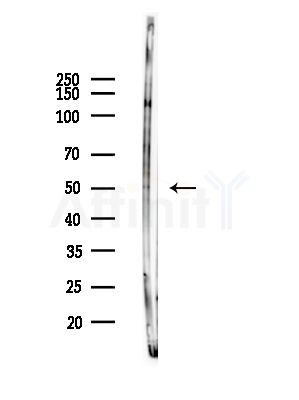 Phospho-NAKED2 (Tyr247) Antibody - Western blot analysis of lysates from HUVEC cells(LPS,4h treatment), using Phospho-NAKED2 (Tyr247) Antibody at 1/1000 dilution.