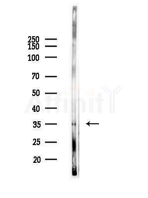 Phospho-CD32 (Tyr288) Antibody - Western blot analysis of lysates from HUVEC cells(LPS,4h treatment), using Phospho-CD32 (Tyr288) Antibody at 1/1000 dilution.