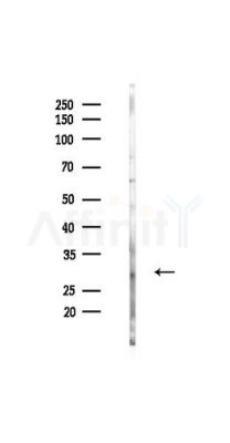 Phospho-CD79B (Tyr207) Antibody - Western blot analysis of lysates from HUVEC cells(UV,30min treatment), using Phospho-CD79B (Tyr207) Antibody at 1/1000 dilution.