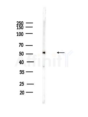 Acetyl-alpha Tubulin (Lys40) Antibody - Western blot analysis of lysates from B16F10-LUC cells(heat-shock,45min treatment), using Acetyl-alpha Tubulin (Lys40) Antibody at 1/1000 dilution.
