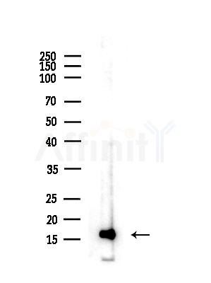 Acetyl-H2B (Lys16) Antibody - Western blot analysis of lysates from Hela cells(heat-shock,45min treatment), using Acetyl-H2B (Lys16) Antibody at 1/1000 dilution.