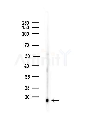 Acetyl-Histone H2B (Lys20)  Antibody - Western blot analysis of lysates from PC12 cells(starvation,24h treatment), using Acetyl-Histone H2B (Lys20)  Antibody at 1/1000 dilution.