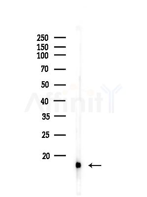 Acetyl-Histone H2B (Lys20)  Antibody - Western blot analysis of lysates from COLO205 cells(heat-shock,45min treatment), using Acetyl-Histone H2B (Lys20)  Antibody at 1/1000 dilution.
