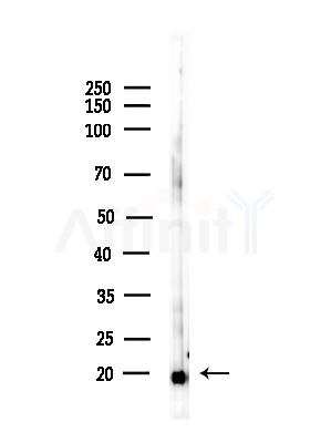 Acetyl-Histone H3 (Lys9/14/18/23/27) Antibody - Western blot analysis of lysates from PC12 cells(starvation,24h treatment), using Acetyl-Histone H3 (Lys9/14/18/23/27) Antibody at 1/1000 dilution.