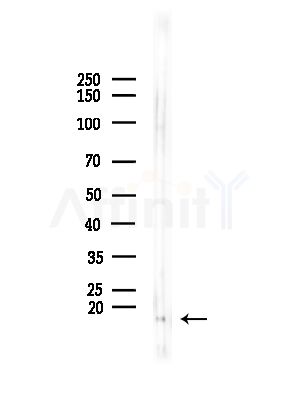 Acetyl-Histone H3 (Lys9/14/18/23/27) Antibody - Western blot analysis of lysates from Mouse muscle, using Acetyl-Histone H3 (Lys9/14/18/23/27) Antibody at 1/1000 dilution.