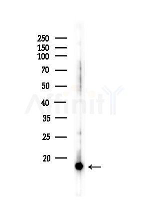 Acetyl-Histone H3 (Lys9/14/18/23/27) Antibody - Western blot analysis of lysates from COLO205 cells(heat-shock,45min treatment), using Acetyl-Histone H3 (Lys9/14/18/23/27) Antibody at 1/1000 dilution.