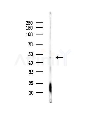 Phospho-eIF4A2 (Tyr49) Antibody - Western blot analysis of lysates from 293 cells(UV treatment), using Phospho-eIF4A2 (Tyr49) Antibody at 1/1000 dilution.