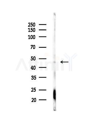 Phospho-eIF4A2 (Tyr49) Antibody - Western blot analysis of lysates from 293 cells(UV treatment), using Phospho-eIF4A2 (Tyr49) Antibody at 1/1000 dilution.