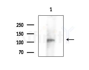 Phospho-EPHA4 (Tyr596) Antibody - Western blot analysis of extracts from EC304 cells, using Phospho-EPHA4 (Tyr596) Antibody at 1/1000 dilution.