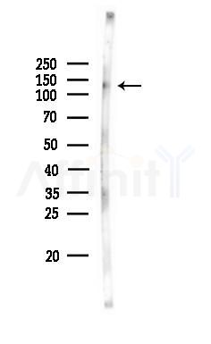 Phospho-EPHA4 (Tyr596) Antibody - Western blot analysis of lysates from EC304 cells, using Phospho-EPHA4 (Tyr596) Antibody at 1/1000 dilution.
