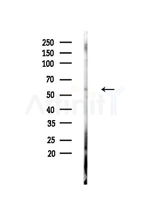 Phospho-DOK2 (Tyr351)[Tyr345] Antibody - Western blot analysis of lysates from MCF7 cells(heat-shock,45min treatment), using Phospho-DOK2 (Tyr351)[Tyr345] Antibody at 1/1000 dilution.