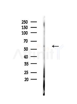Phospho-DOK2 (Tyr351)[Tyr345] Antibody - Western blot analysis of lysates from MCF7 cells(heat-shock,45min treatment), using Phospho-DOK2 (Tyr351)[Tyr345] Antibody at 1/1000 dilution.