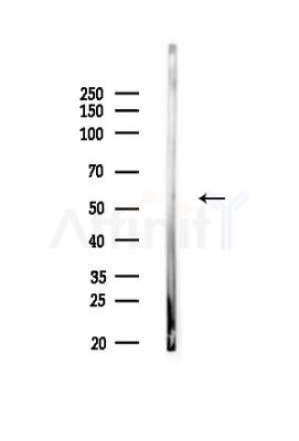 Phospho-DOK2 (Tyr351)[Tyr345] Antibody - Western blot analysis of lysates from Mouse testis, using Phospho-DOK2 (Tyr351)[Tyr345] Antibody at 1/1000 dilution.