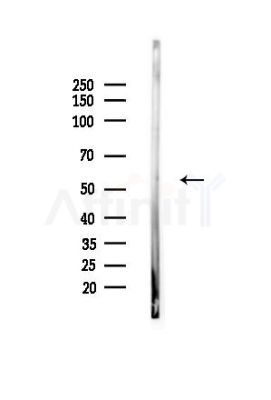 Phospho-DOK2 (Tyr351)[Tyr345] Antibody - Western blot analysis of lysates from Mouse testis, using Phospho-DOK2 (Tyr351)[Tyr345] Antibody at 1/1000 dilution.