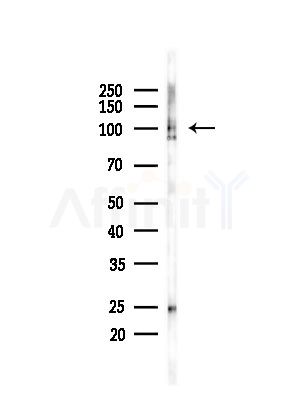 Phospho-Catenin 1 (Ser320) Antibody - Western blot analysis of lysates from LoVo cells(heat-shock,45min treatment), using Phospho-Catenin 1 (Ser320) Antibody at 1/1000 dilution.