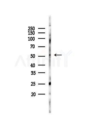 Phospho-PFKFB2 (Ser483)  Antibody - Western blot analysis of lysates from RAW264.