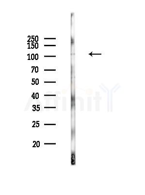 Phospho-ATP1A1 (Tyr10) Antibody - Western blot analysis of lysates from PC12 cells(UV,30min treatment), using Phospho-ATP1A1 (Tyr10) Antibody at 1/1000 dilution.