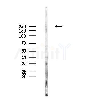 Phospho-MAP2 (Thr1620/Thr1623) Antibody - Western blot analysis of lysates from HUVEC cells(UV,30min treatment), using Phospho-MAP2 (Thr1620/Thr1623) Antibody at 1/1000 dilution.