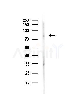 Phospho-HCLS1 (Tyr397) Antibody - Western blot analysis of lysates from Mouse brain, using Phospho-HCLS1 (Tyr397) Antibody at 1/1000 dilution.