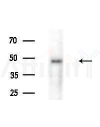 Phospho-Cyclin B1 (Ser116) Antibody - Western blot analysis of extracts from various samples, using Phospho-Cyclin B1 (Ser116) Antibody at 1/1000 dilution.