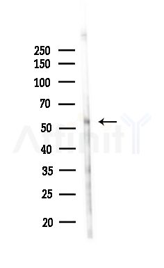 Phospho-Cyclin B1 (Ser116) Antibody - Western blot analysis of lysates from HepG2 cells(heat-shock,45min treatment), using Phospho-Cyclin B1 (Ser116) Antibody at 1/1000 dilution.