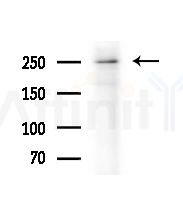 Phospho-Desmoplakin (Ser165/Ser166) Antibody - Western blot analysis of extracts from Rat brain, using Phospho-Desmoplakin (Ser165/Ser166) Antibody at 1/1000 dilution.