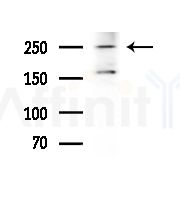 Phospho-Desmoplakin (Ser165/Ser166) Antibody - Western blot analysis of extracts from A375 cells(heat-shock,45min treatment), using Phospho-Desmoplakin (Ser165/Ser166) Antibody at 1/1000 dilution.
